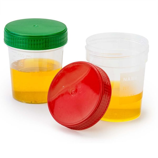 Specimen container, 4oz, red separate screwcap, PK